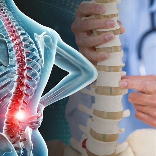 Stem Cells for Spinal Stenosis KRMC.jpg